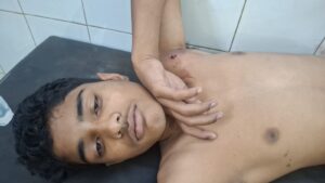 बलिया में गोलीकांड से हड़कंप, चाचा ने भतीजे को मारी गोली